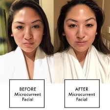 What Is a Microcurrent Facial? - Microcurrent Facial Review ...